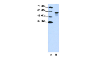 U2AF2 Rabbit Polyclonal Antibody