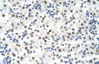 DDX19B Rabbit Polyclonal Antibody
