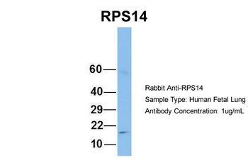 RPS14 Rabbit Polyclonal Antibody