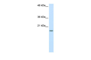 RPS14 Rabbit Polyclonal Antibody
