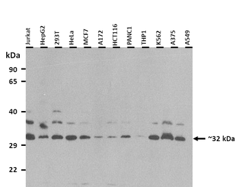 U2AF1 Rabbit Polyclonal Antibody