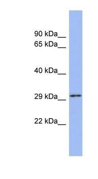 U2AF1 Rabbit Polyclonal Antibody