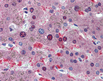 CUGBP1 Rabbit Polyclonal Antibody