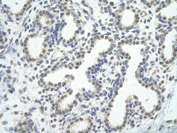CDC5L Rabbit Polyclonal Antibody