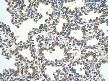CSTF2 Rabbit Polyclonal Antibody