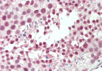 CSTF2 Rabbit Polyclonal Antibody