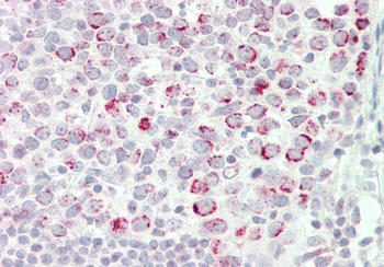 CSTF2 Rabbit Polyclonal Antibody