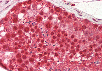 Cstf2 Rabbit Polyclonal Antibody