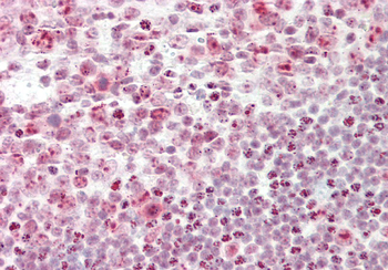 CSTF3 Rabbit Polyclonal Antibody
