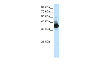 CSTF3 Rabbit Polyclonal Antibody