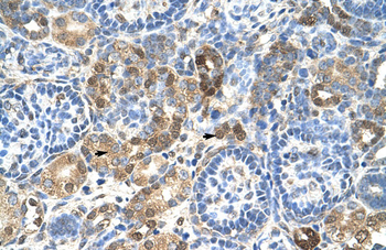 HNRPL Rabbit Polyclonal Antibody