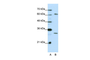 AUH Rabbit Polyclonal Antibody