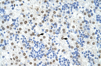 HNRPA1 Rabbit Polyclonal Antibody