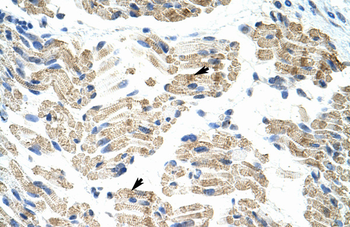 HNRPK Rabbit Polyclonal Antibody