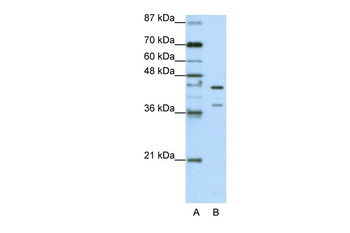 HNRPK Rabbit Polyclonal Antibody