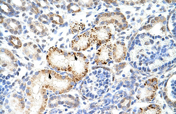 HNRPK Rabbit Polyclonal Antibody