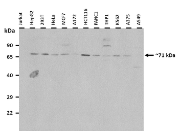 PABPC1 Rabbit Polyclonal Antibody