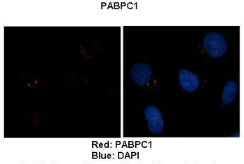 PABPC1 Rabbit Polyclonal Antibody