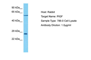 PIGF Rabbit Polyclonal Antibody