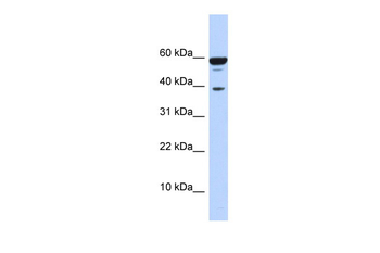 PPP1R8 Rabbit Polyclonal Antibody