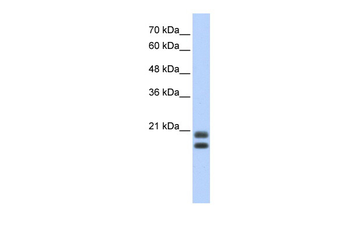 SRGN Rabbit Polyclonal Antibody