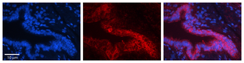 PSMA1 Rabbit Polyclonal Antibody