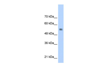 PTBP1 Rabbit Polyclonal Antibody