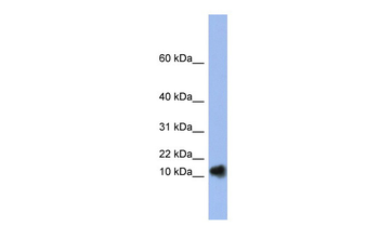RNASE1 Rabbit Polyclonal Antibody