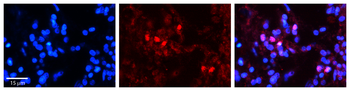 SNRP70 Rabbit Polyclonal Antibody