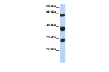 SNRPB Rabbit Polyclonal Antibody