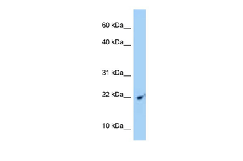 SRP14 Rabbit Polyclonal Antibody