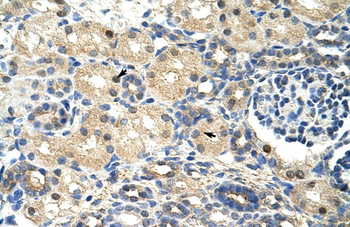 SRP14 Rabbit Polyclonal Antibody