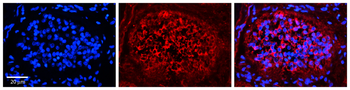 XPO1 Rabbit Polyclonal Antibody