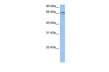 TAF15 Rabbit Polyclonal Antibody