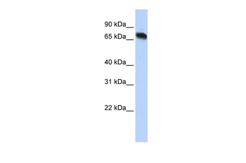 TAF15 Rabbit Polyclonal Antibody