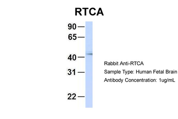RTCD1 Rabbit Polyclonal Antibody