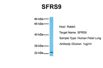 SFRS9 Rabbit Polyclonal Antibody