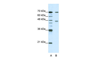 PABPC4 Rabbit Polyclonal Antibody
