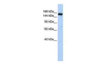 SYNJ1 Rabbit Polyclonal Antibody