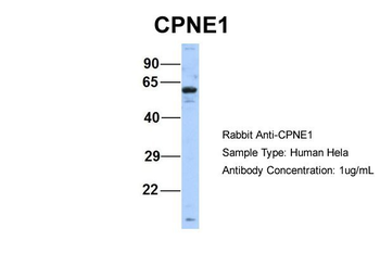 CPNE1 Rabbit Polyclonal Antibody
