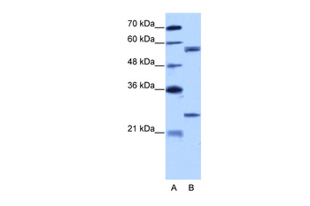 CPNE1 Rabbit Polyclonal Antibody