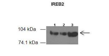 IREB2 Rabbit Polyclonal Antibody