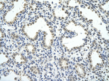 HNRPAB Rabbit Polyclonal Antibody