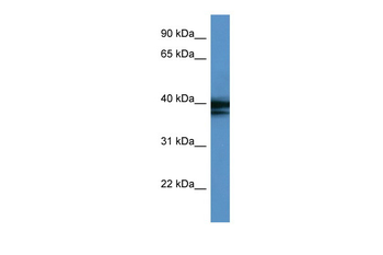 HNRPAB Rabbit Polyclonal Antibody