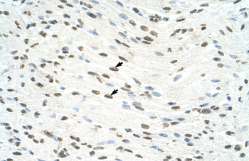 ILF3 Rabbit Polyclonal Antibody