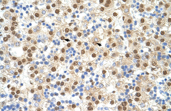 ILF3 Rabbit Polyclonal Antibody