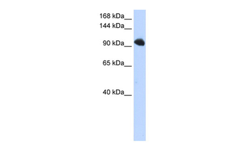 SFRS8 Rabbit Polyclonal Antibody
