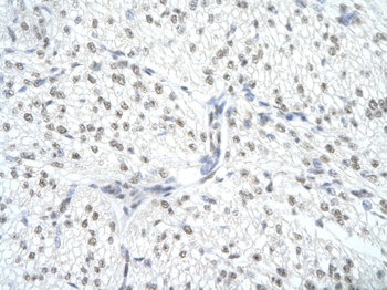 SNRPA Rabbit Polyclonal Antibody