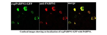 PABPN1 Rabbit Polyclonal Antibody