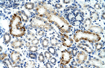 ZRSR2 Rabbit Polyclonal Antibody